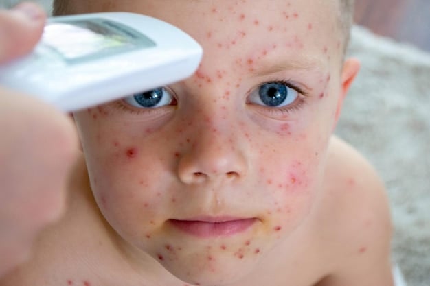 Child With Freckles Undergoing Temperature Check image in article Splinters, Stings, and Rashes: Quick Response Guide for Providers